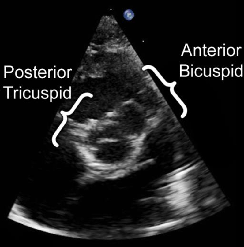 Figure 4