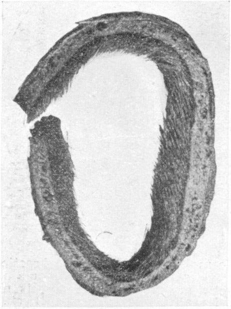 Fig. 12