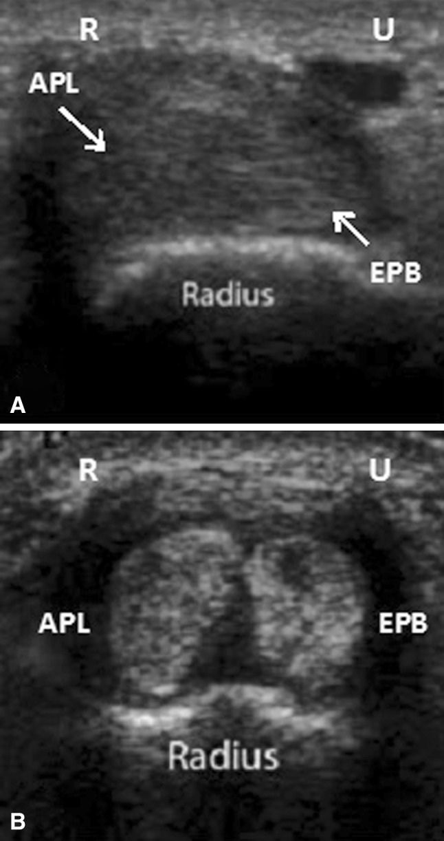 Fig. 2A–B