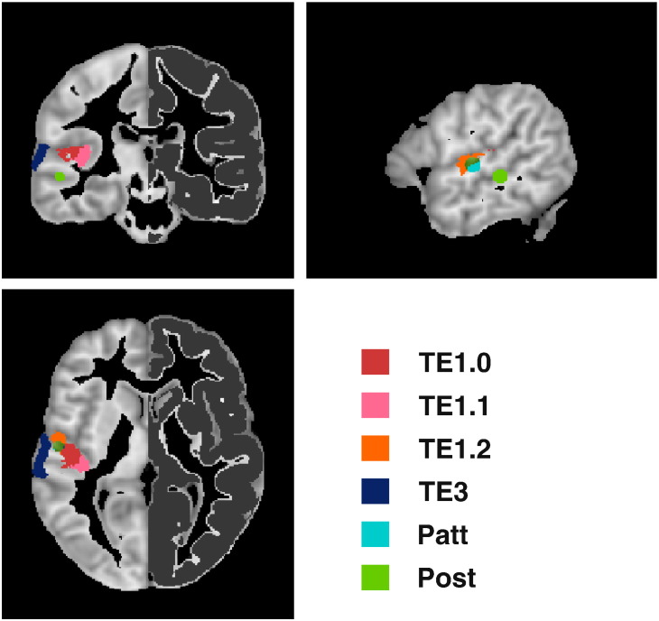 Fig. 1