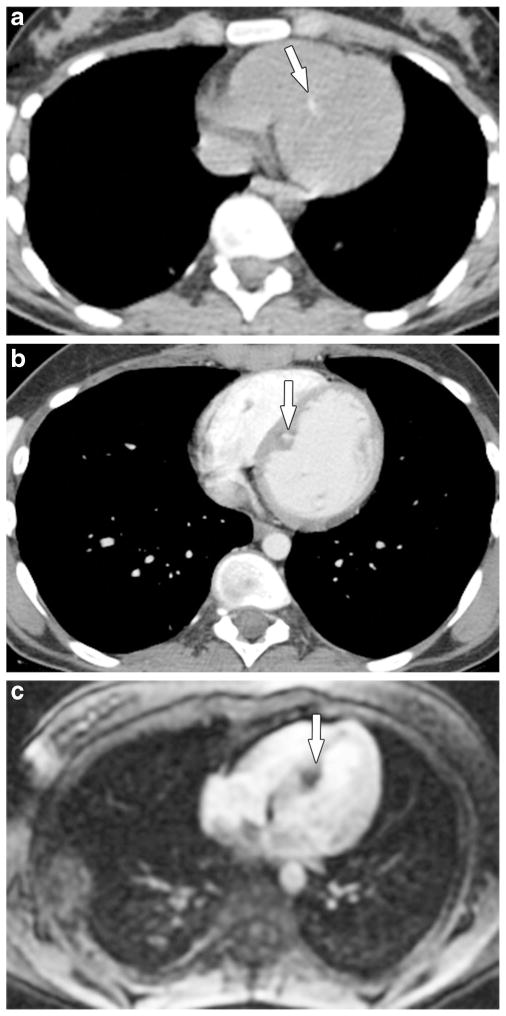 Fig. 9