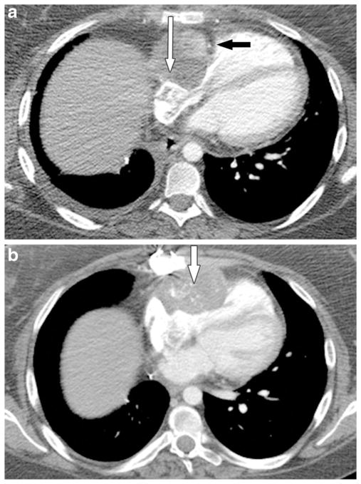 Fig. 10