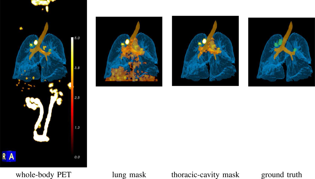 Fig. 12