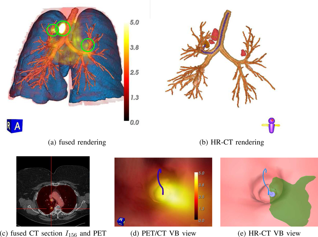 Fig. 14