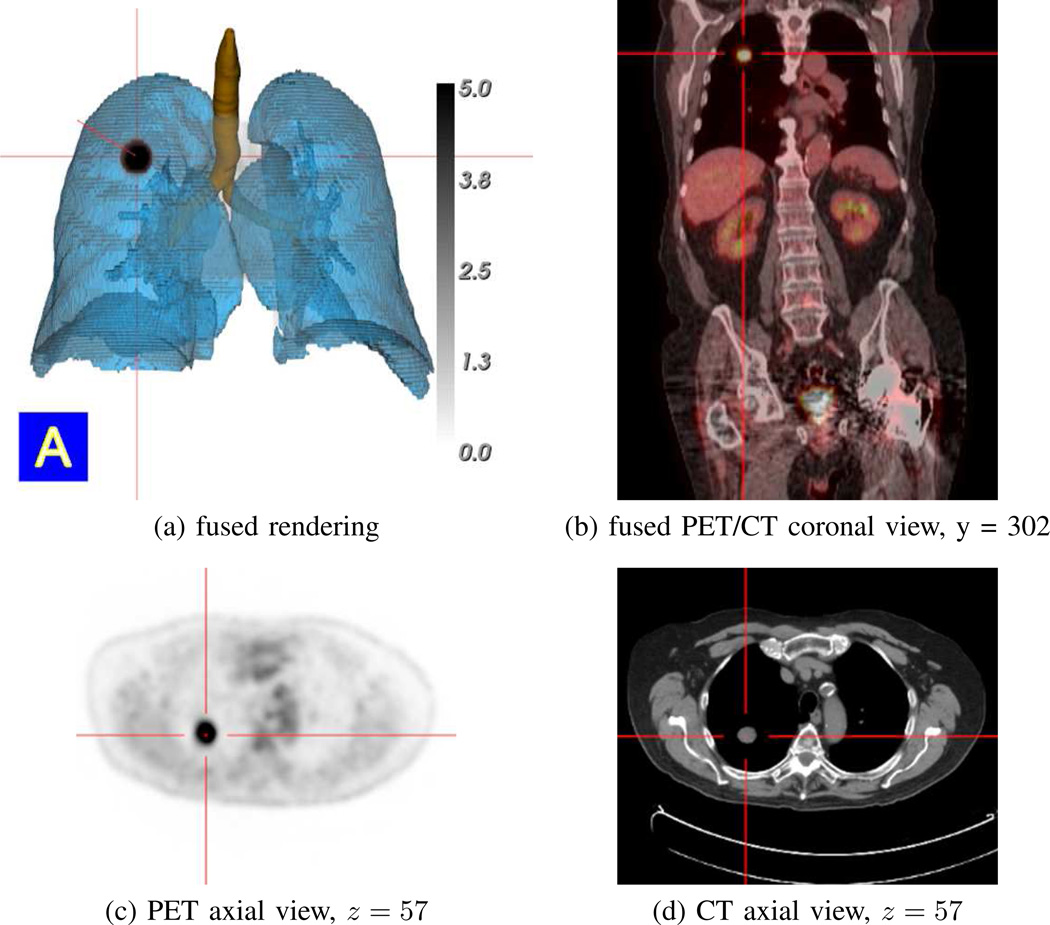 Fig. 13