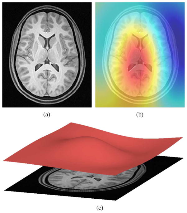 Fig. 1