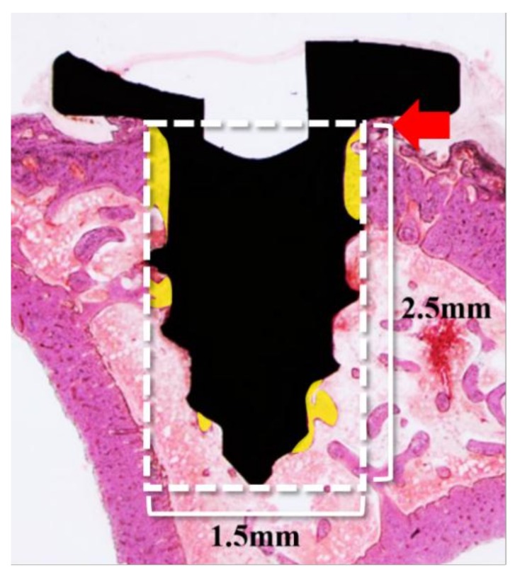 Figure 11