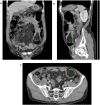 Fig. 2
