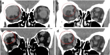 Fig. 4