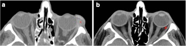 Fig. 3