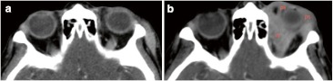 Fig. 5