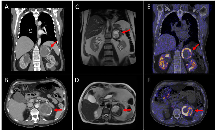 Figure 2