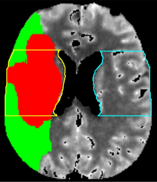 Fig. 1