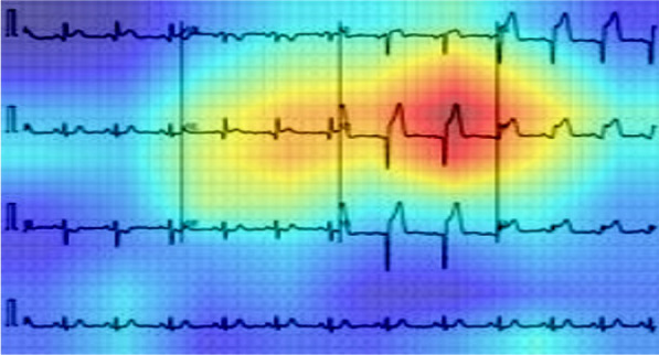 Fig. 2