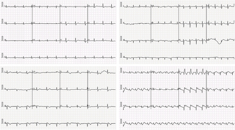 Fig. 5