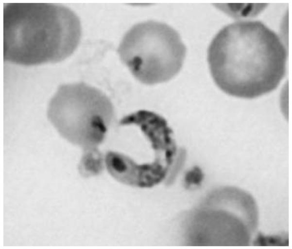 Malaria parasite transmission form in the blood.