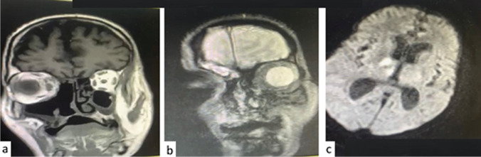 Fig. 8