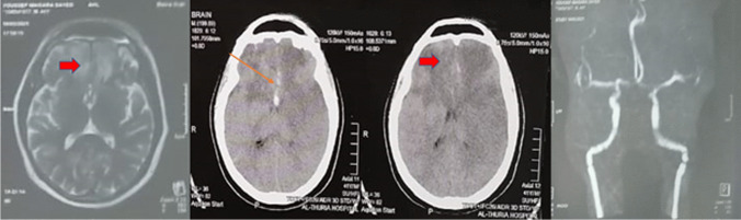 Fig. 6