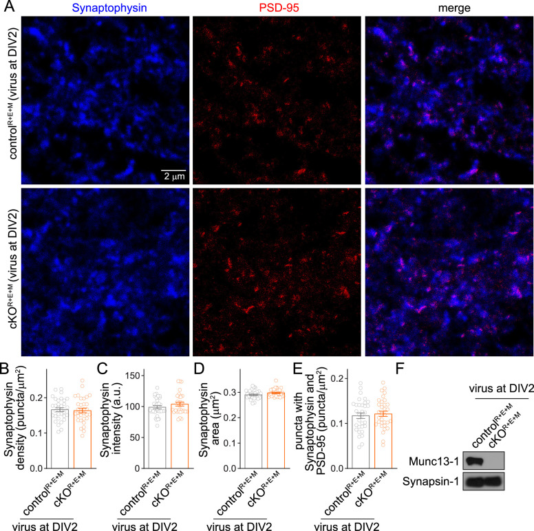 Figure 2—figure supplement 2.