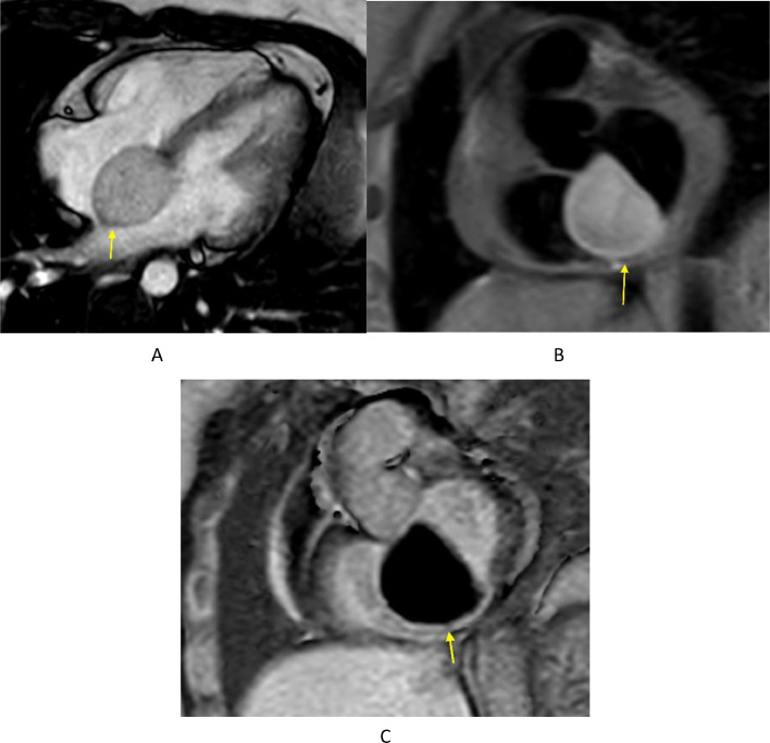 Fig 3