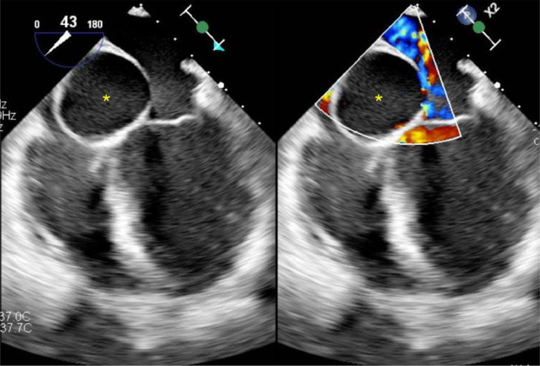 Fig 2