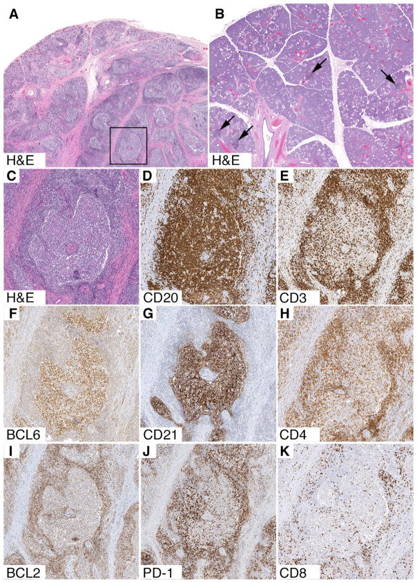 FIG 1