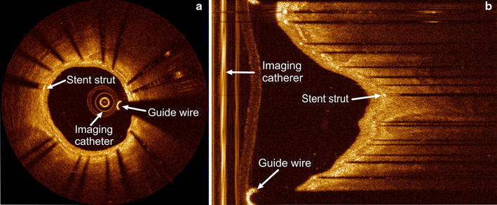 Fig. 1