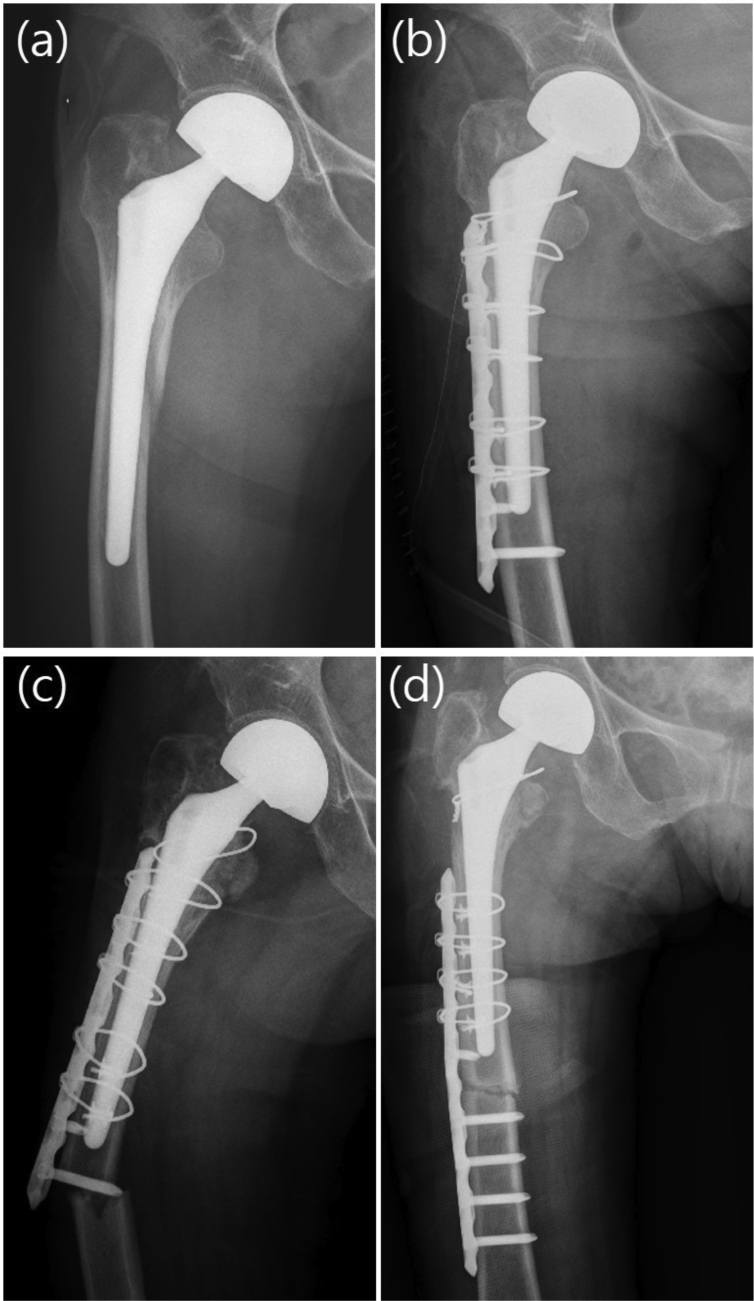 Fig. 2