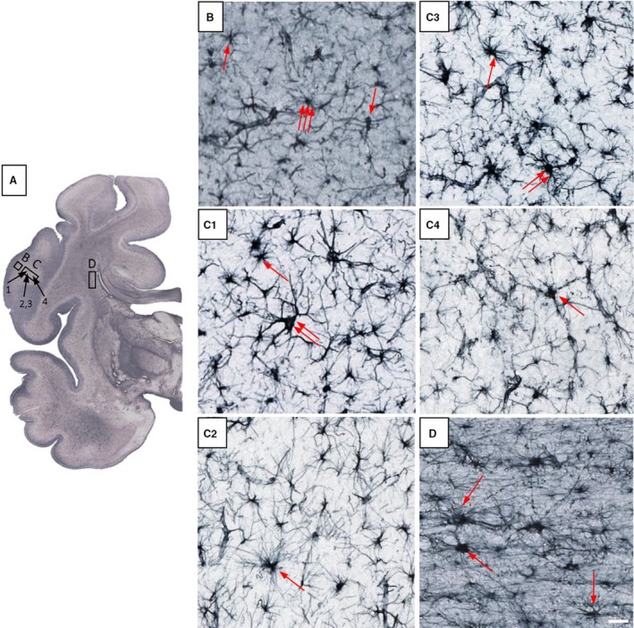 Figure 13