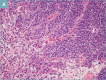Figure 1a.
