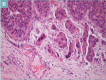 Figure 1b.