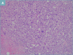 Figure 2a.