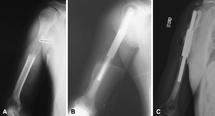 Fig. 5A–C