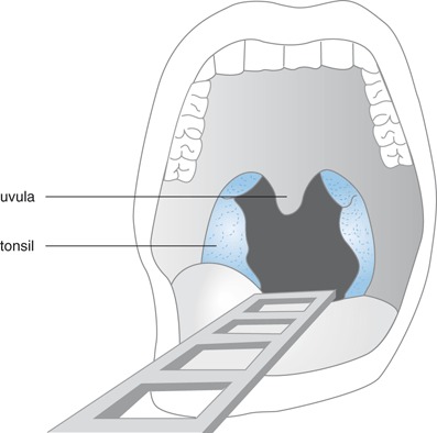 graphic file with name 978-90-313-9807-2_17_Fig2_HTML.jpg