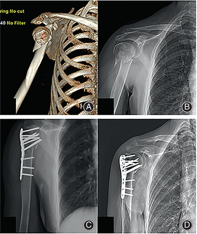 Fig. 7