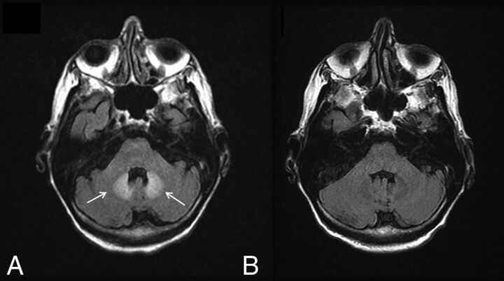 Fig 4.