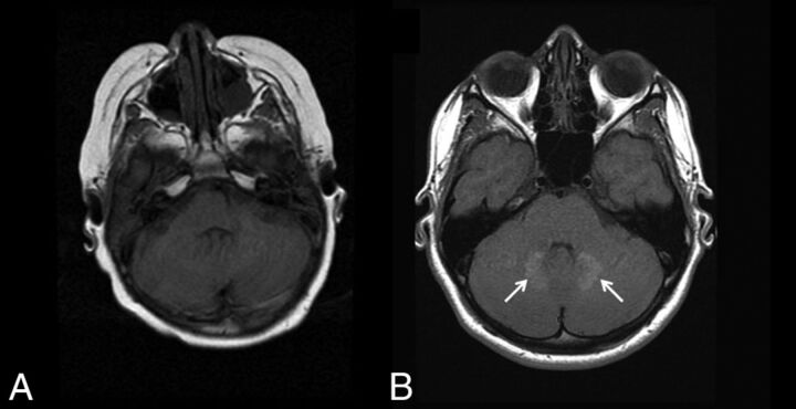 Fig 5.