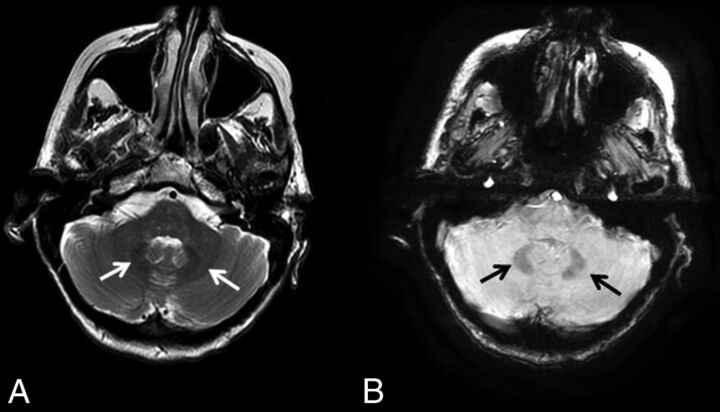 Fig 6.