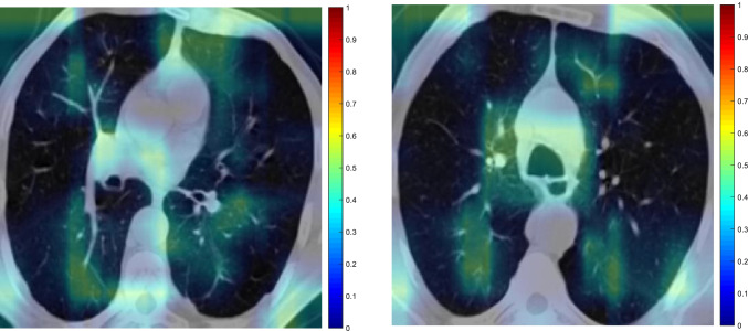 Fig. 19