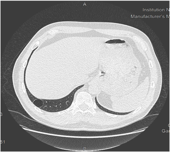 FIGURE 2