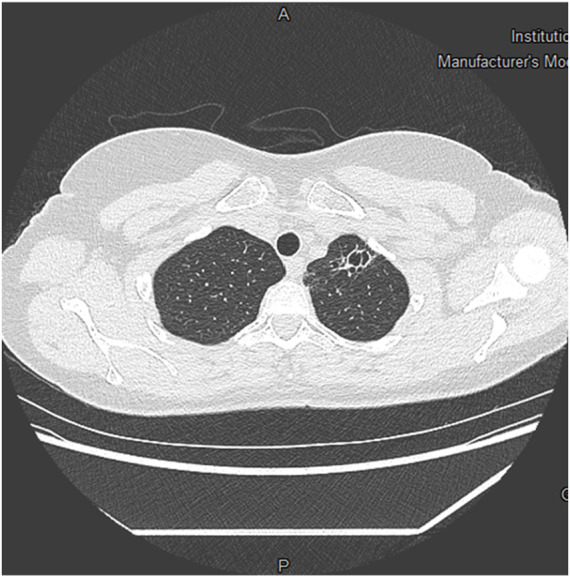 FIGURE 3