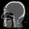 Fig. 10.