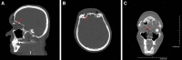 Fig. 8.