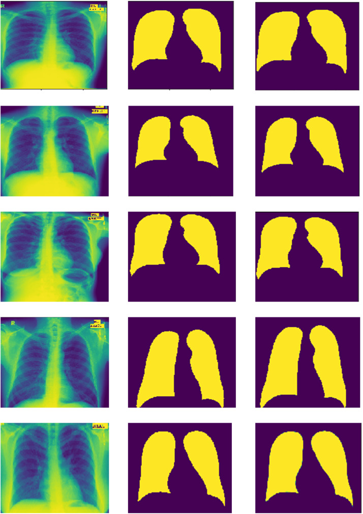 Fig. 11