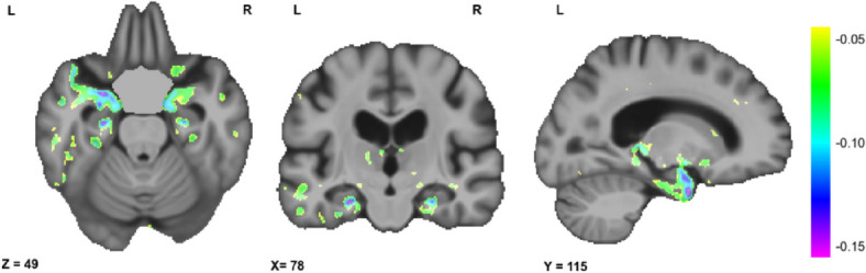 Fig. 4