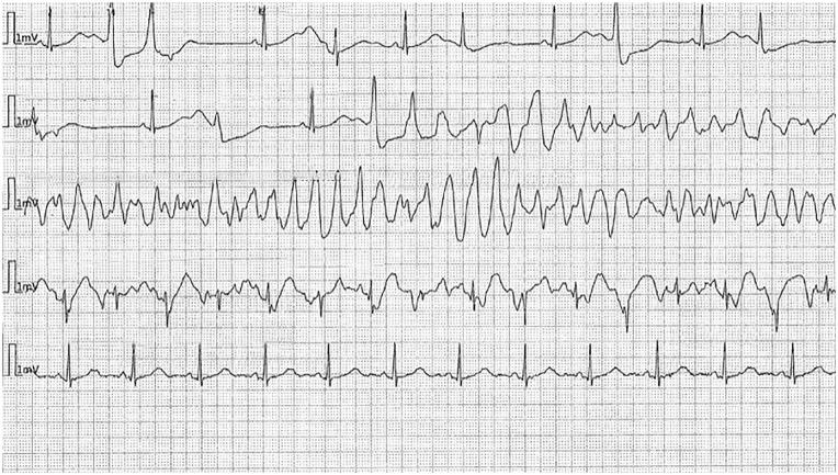 Figure 6.