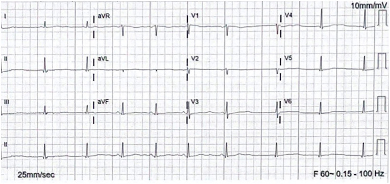 Figure 2.