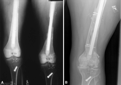 Fig. 4A–B