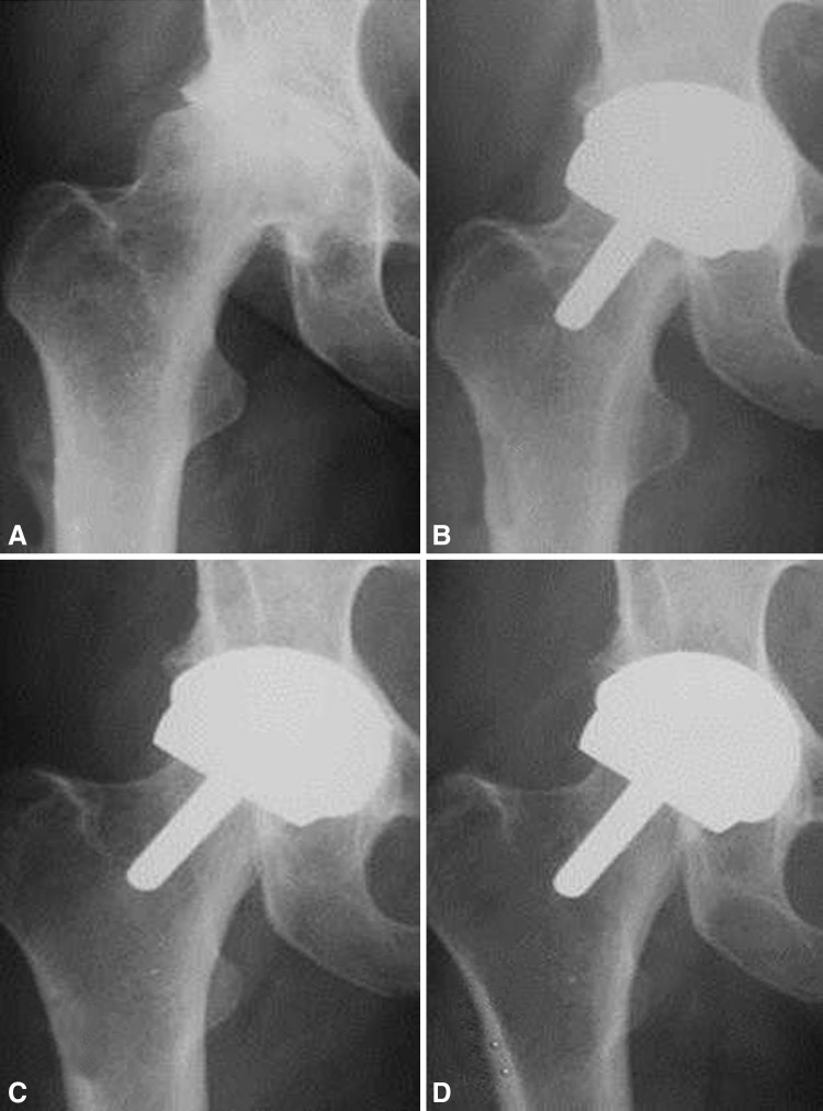 Fig. 4A–D