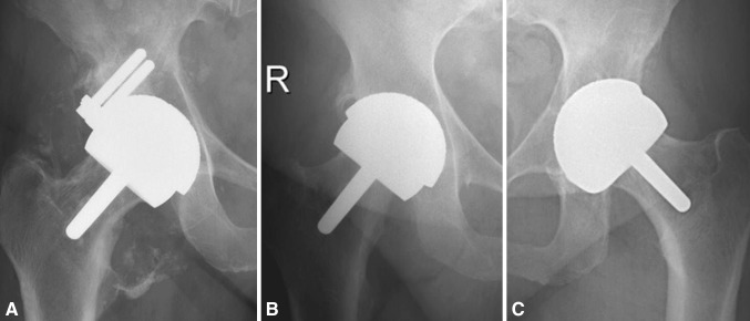 Fig. 3A–C